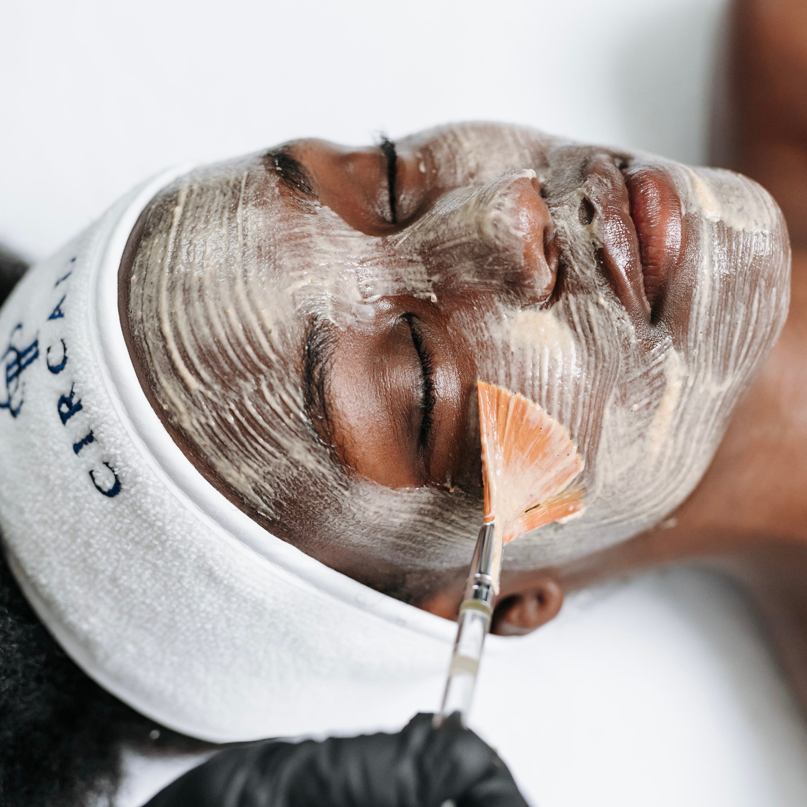 Acne & Resurfacing Treatments