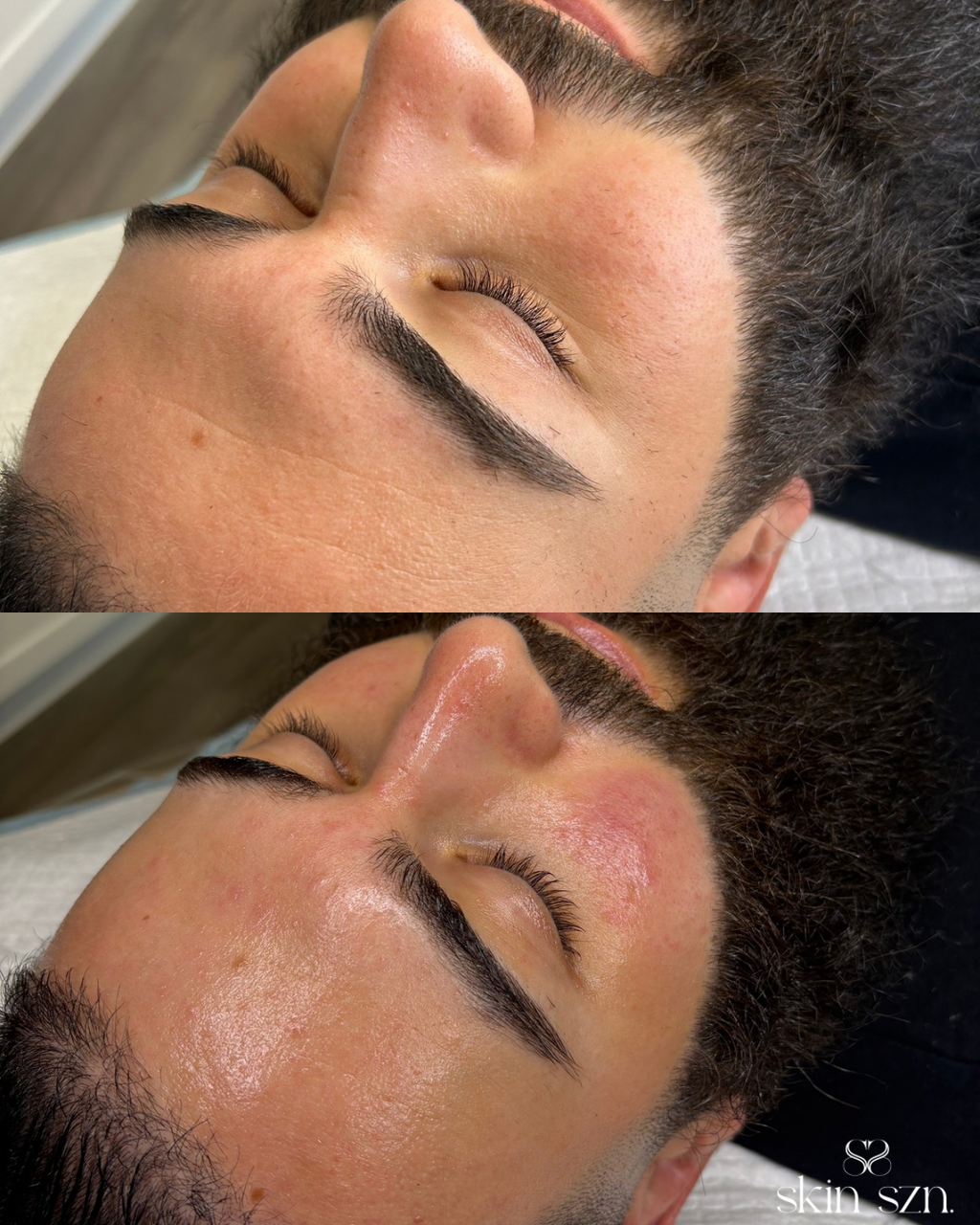 Gentlemen’s Facial